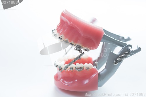 Image of Dental lower jaw bracket braces model on white