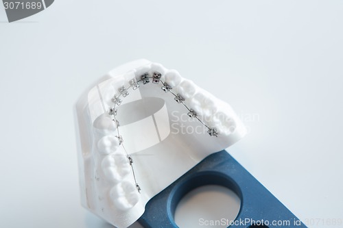 Image of Dental lower jaw bracket braces model on white