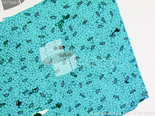 Image of Stoma micrograph