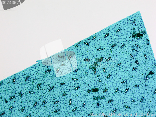 Image of Stoma micrograph