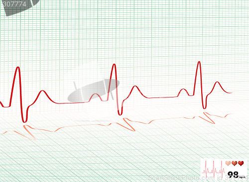 Image of heart beat green grid