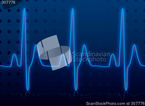 Image of heartbeat glow