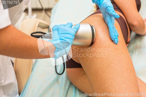 Image of procedure