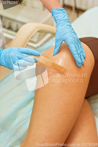 Image of procedure
