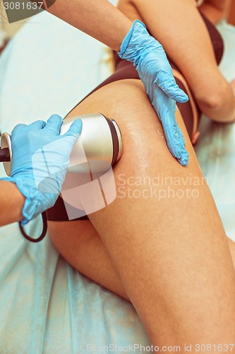 Image of procedure
