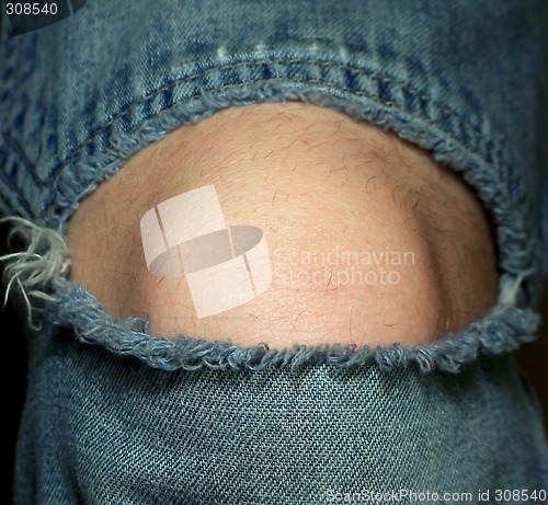 Image of Knee in Jeans