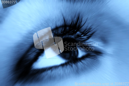 Image of Black eye