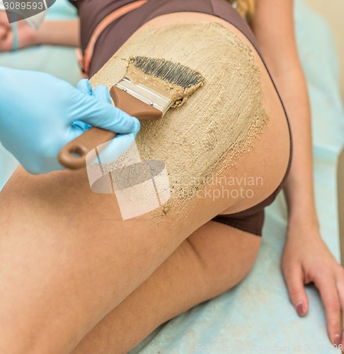 Image of procedure