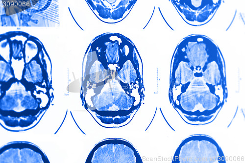 Image of CT and MRI of the skull