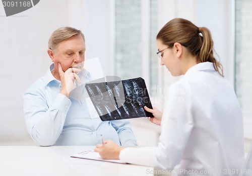 Image of female doctor with old man looking at x-ray