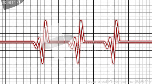 Image of Electrocardiogram - Concept of healthcare