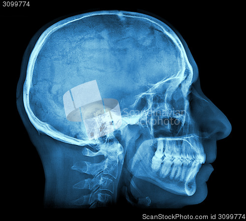 Image of Human skull X-ray image