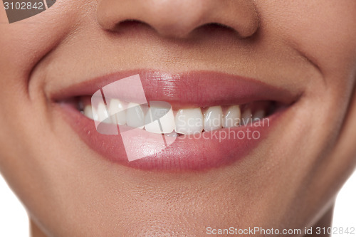 Image of Dental health.
