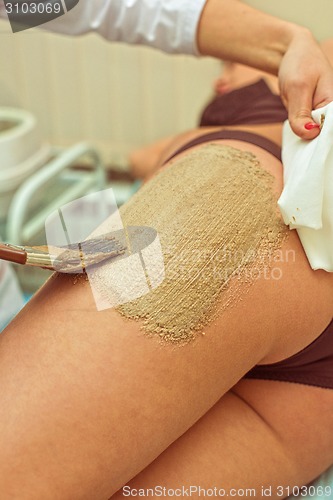 Image of procedure