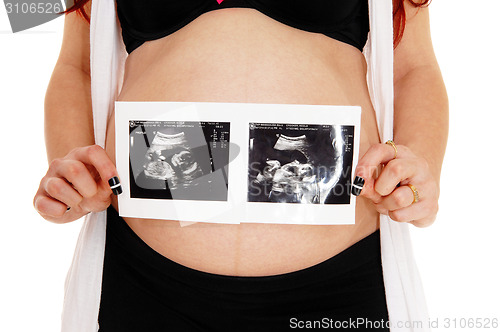 Image of Pregnant women with ultrasound picture.