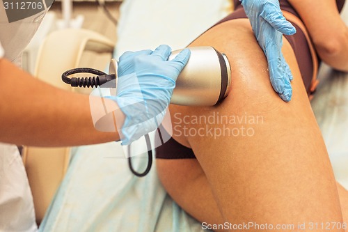 Image of procedure