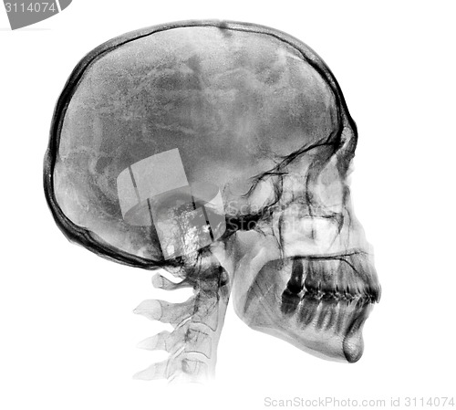 Image of Detailed Human skull X-ray image