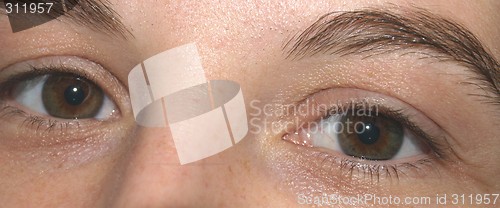 Image of eyes