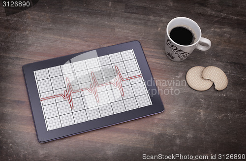 Image of Electrocardiogram on a tablet - Concept of healthcare