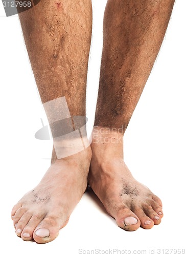 Image of dirty feet