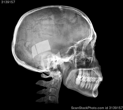 Image of Human skull X-ray image