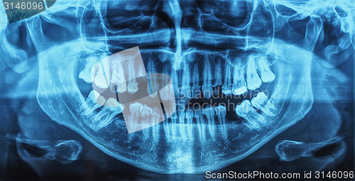 Image of Medical Xray