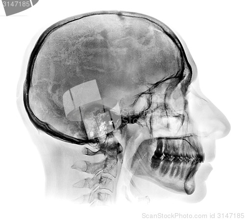 Image of Detailed Human skull X-ray image