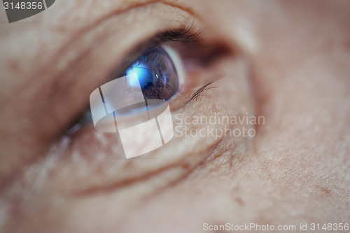 Image of Vision