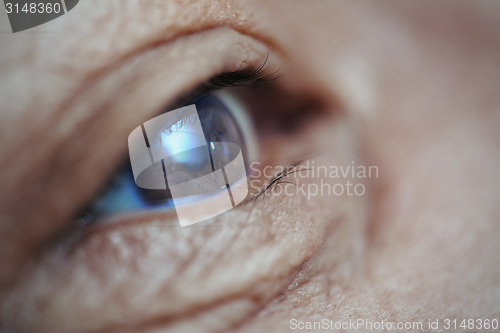 Image of Vision