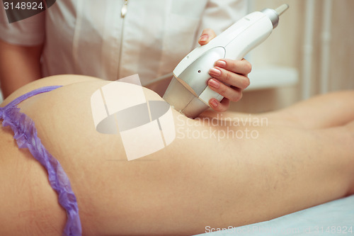 Image of procedure