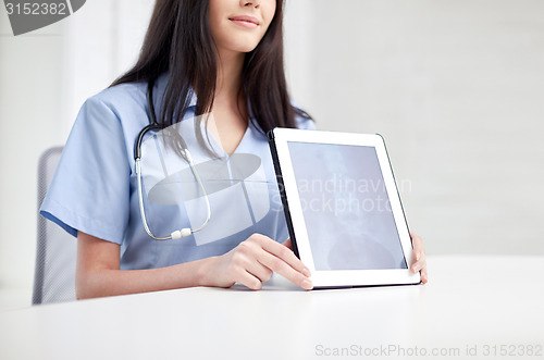 Image of close up of doctor showing x-ray on tablet pc