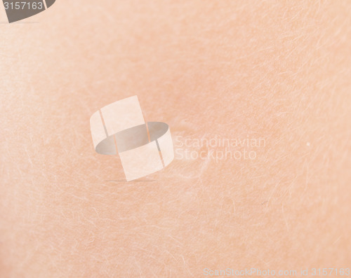 Image of baby skin