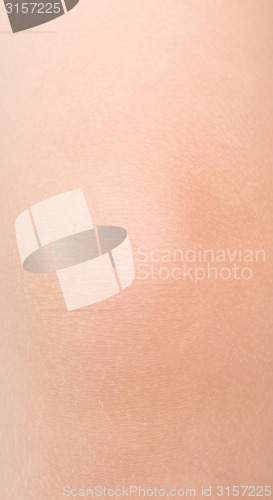 Image of baby knee