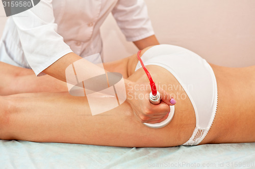 Image of procedure