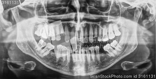 Image of Medical Xray