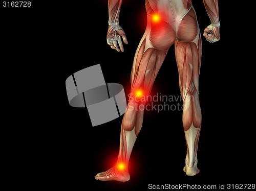 Image of Conceptual human body anatomy pain on black
