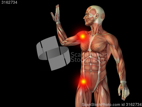 Image of Conceptual human body anatomy pain on black