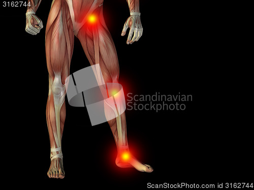 Image of Conceptual human body anatomy pain on black