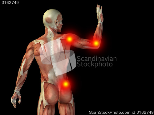 Image of Conceptual human body anatomy pain on black