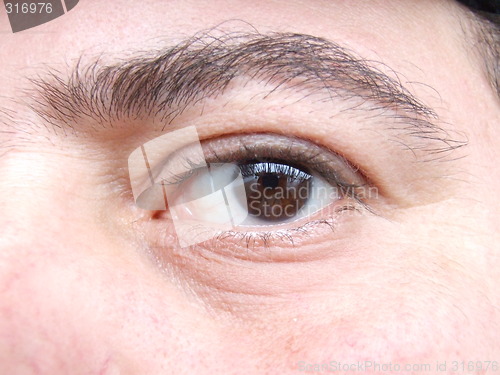 Image of brown eye