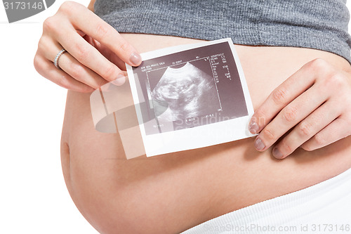 Image of Pregnant woman displaying a prenatal ultrasound