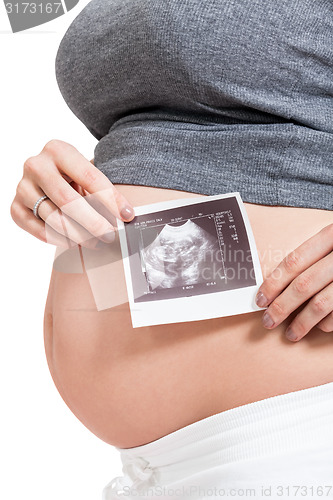 Image of Pregnant woman displaying a prenatal ultrasound