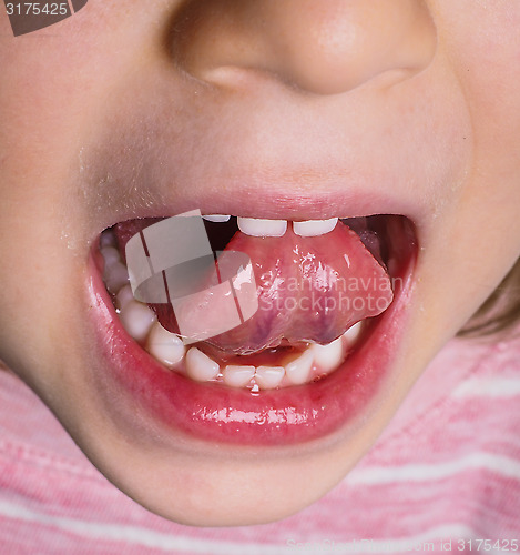 Image of Little girl with pink shirt protruding tongue backwards with man