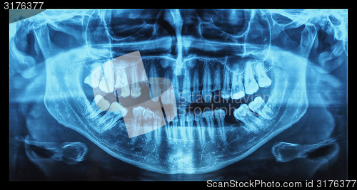 Image of Medical Xray