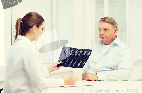 Image of female doctor with old man looking at x-ray