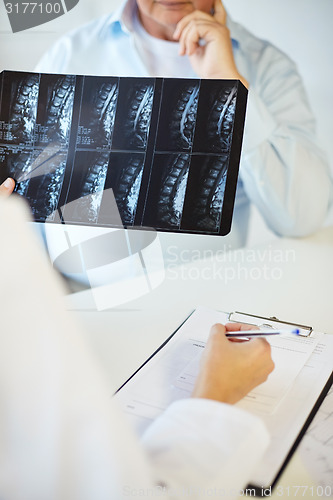 Image of close up of senior patient and doctor with x-ray