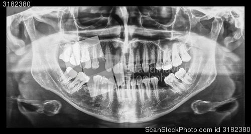 Image of Medical Xray