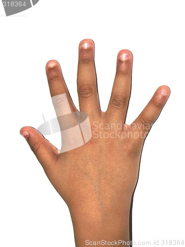 Image of right hand