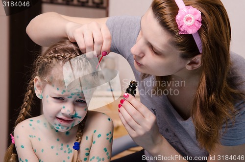Image of Mom plaster zelenkoj child with chickenpox sores