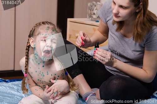 Image of Girl suffering from chicken pox crying when my mother misses sores zelenkoj